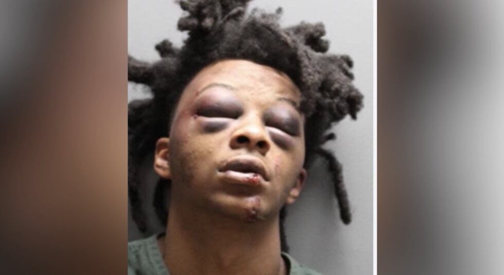 The sheriff says the man seen being punched in an arrest video was involved in a possible drug...